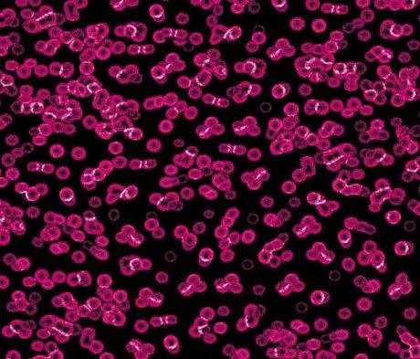 Ковролин Forbo Flotex Sottsass Bacteria 990101 