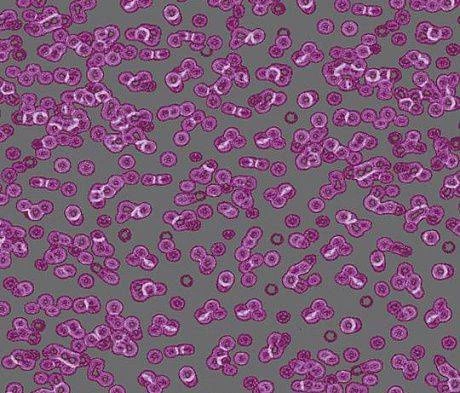 Ковролин Forbo Flotex Sottsass Bacteria 990301 