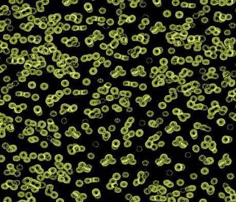 Ковролин Forbo Flotex Sottsass Bacteria 990103 