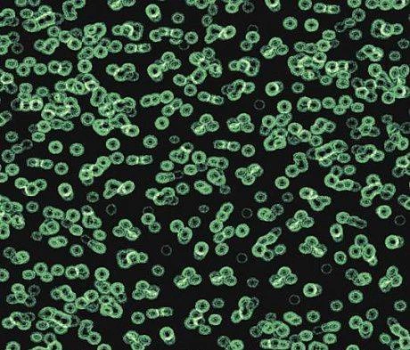 Ковролин Forbo Flotex Sottsass Bacteria 990102 